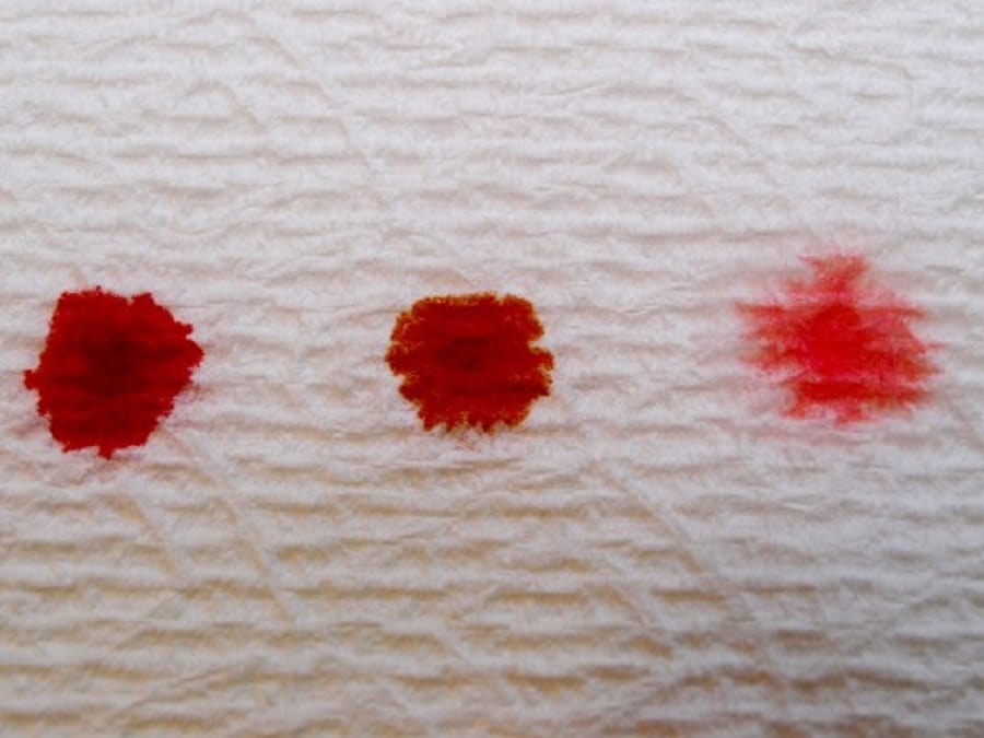 sangramento no início da gravidez
