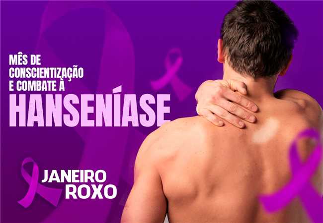 Capacitação profissional para ampliar combate a Hanseníase