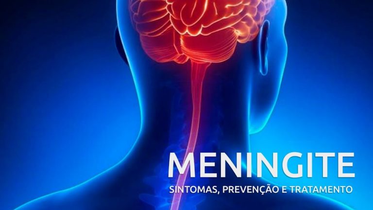 Tudo que você precisa saber sobre a Meningite